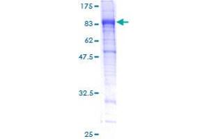 Image no. 1 for Integrin alpha FG-GAP Repeat Containing 3 (ITFG3) (AA 1-552) protein (GST tag) (ABIN1308159)