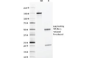 Image no. 3 for anti-serpin Peptidase Inhibitor, Clade A (Alpha-1 Antiproteinase, Antitrypsin), Member 1 (SERPINA1) antibody (ABIN6940312)