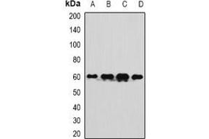 Image no. 3 for anti-Alveolar Soft Part Sarcoma Chromosome Region, Candidate 1 (ASPSCR1) antibody (ABIN2967121)