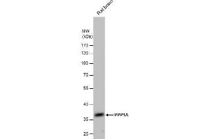 Image no. 4 for anti-Protein Phosphatase 1, Catalytic Subunit, alpha Isoform (PPP1CA) (Center) antibody (ABIN2856071)