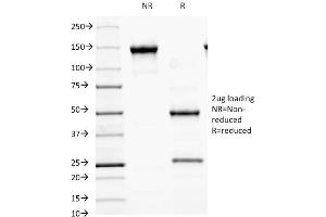 Image no. 3 for anti-Mucosa Associated Lymphoid Tissue Lymphoma Translocation Gene 1 (MALT1) (AA 701-808) antibody (ABIN6939110)