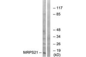 Image no. 1 for anti-Mitochondrial Ribosomal Protein S21 (MRPS21) (AA 38-87) antibody (ABIN1535021)