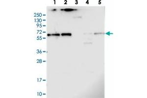 Image no. 1 for anti-Coiled-Coil Domain Containing 125 (CCDC125) antibody (ABIN5573882)