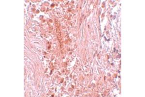 Image no. 2 for anti-Protein Inhibitor of Activated STAT, 3 (PIAS3) (C-Term) antibody (ABIN6656302)