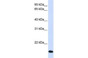 Image no. 1 for anti-Ring Finger Protein 185 (RNF185) (Middle Region) antibody (ABIN2781255)
