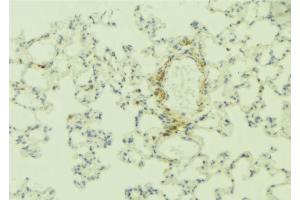 Image no. 3 for anti-Integrin beta 4 (ITGB4) antibody (ABIN6262617)