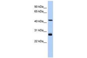 Image no. 1 for anti-Synaptotagmin IX (SYT9) (AA 179-228) antibody (ABIN6743740)