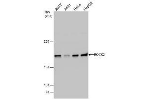 Image no. 7 for anti-rho-Associated, Coiled-Coil Containing Protein Kinase 2 (ROCK2) (Center) antibody (ABIN2855440)