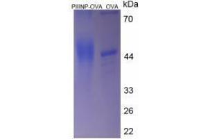 Image no. 1 for Procollagen III N-Terminal Propeptide (PIIINP) (N-Term) peptide (Ovalbumin) (ABIN5666355)