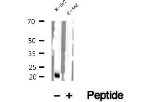 Image no. 1 for anti-NADH Dehydrogenase (Ubiquinone) Fe-S Protein 7, 20kDa (NADH-Coenzyme Q Reductase) (NDUFS7) (Internal Region) antibody (ABIN6263575)