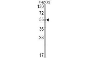 Image no. 1 for anti-Solute Carrier Family 38 Member 3 (SLC38A3) (Middle Region) antibody (ABIN453380)