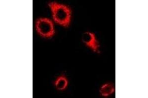 Image no. 1 for anti-Seryl-tRNA Synthetase (SARS) antibody (ABIN2967023)