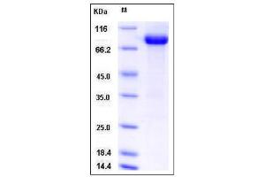 Image no. 1 for Discoidin Domain Receptor tyrosine Kinase 1 (DDR1) (AA 1-414), (Extracellular Domain) protein (Fc Tag) (ABIN2008354)