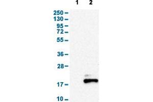 Image no. 1 for anti-Somatostatin (SST) (AA 25-107) antibody (ABIN5774350)