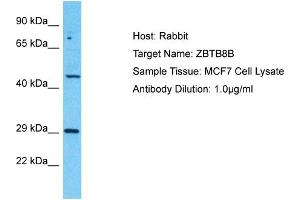 Image no. 1 for anti-Zinc Finger and BTB Domain Containing 8B (ZBTB8B) (C-Term) antibody (ABIN2792048)