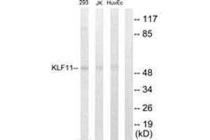 Image no. 1 for anti-Kruppel-Like Factor 11 (KLF11) (AA 1-50) antibody (ABIN1533490)