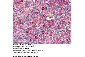 BCL11A antibody  (N-Term)
