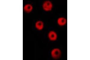 Image no. 2 for anti-Heterogeneous Nuclear Ribonucleoprotein M (HNRNPM) antibody (ABIN6262325)