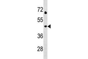 Image no. 3 for anti-Lysosomal-Associated Membrane Protein 3 (LAMP3) (AA 8-38) antibody (ABIN3028815)