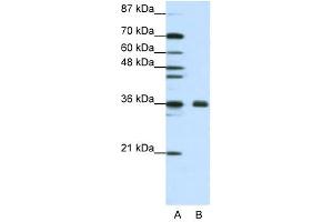 Image no. 2 for anti-Fibrillarin (FBL) (N-Term) antibody (ABIN629933)