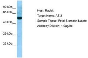 Image no. 1 for anti-Abl-Interactor 2 (ABI2) (N-Term) antibody (ABIN6749949)