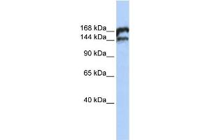 Image no. 2 for anti-Topoisomerase (DNA) II beta 180kDa (TOP2B) (Middle Region) antibody (ABIN2780351)