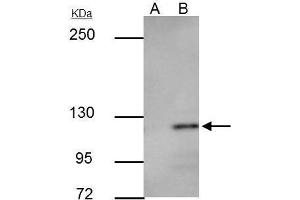 Image no. 5 for anti-Cadherin 1, Type 1, E-Cadherin (Epithelial) (CDH1) (Center) antibody (ABIN2854751)