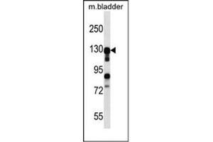Image no. 1 for anti-MKL/myocardin-Like 2 (MKL2) (AA 82-112), (N-Term) antibody (ABIN953457)