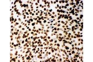 ICC testing of (m) NIH3T3 cells