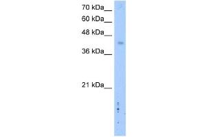 Image no. 1 for anti-Leucine Rich Repeat Containing 2 (LRRC2) (C-Term) antibody (ABIN2775504)