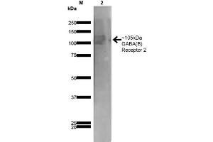 Image no. 1 for anti-gamma-aminobutyric Acid (GABA) B Receptor, 2 (GABBR2) (AA 861-912) antibody (HRP) (ABIN2484085)