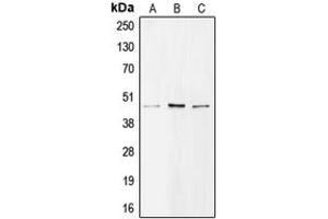 Western blot analysis of BMP8A expression in H1299 (A), A549 (B), Raji (C) whole cell lysates.