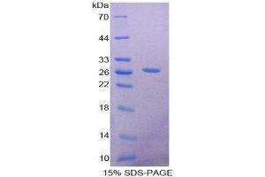 Image no. 1 for SRY (Sex Determining Region Y)-Box 18 (SOX18) (AA 153-377) protein (His tag) (ABIN2126735)