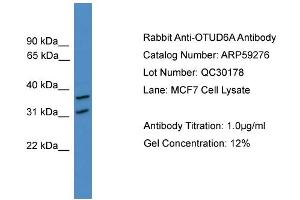 Image no. 1 for anti-OTU Domain Containing 6A (OTUD6A) (N-Term) antibody (ABIN2774251)