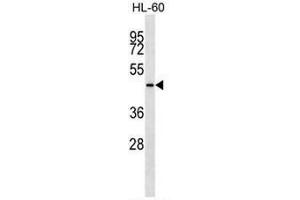 Image no. 1 for anti-Cytokeratin 28 (KRT28) (AA 431-460), (C-Term) antibody (ABIN951815)