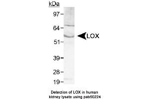 Image no. 2 for anti-Lysyl Oxidase (LOX) (AA 200-300), (Internal Region) antibody (ABIN363533)