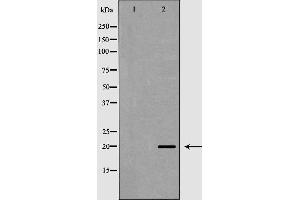 Image no. 1 for anti-RNA Polymerase II TBP-Associated Factor Subunit G (TAF9) (Internal Region) antibody (ABIN6265441)