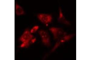 Image no. 1 for anti-PYD and CARD Domain Containing (PYCARD) (N-Term) antibody (ABIN6264533)