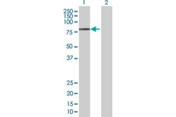 anti-Zinc Finger and BTB Domain Containing 22 (ZBTB22) (AA 1-634) antibody