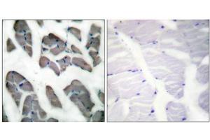 Image no. 4 for anti-Actin, gamma 2, Smooth Muscle, Enteric (ACTG2) (N-Term) antibody (ABIN1848424)