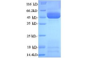 Image no. 1 for Hydroxysteroid (11-Beta) Dehydrogenase 2 (HSD11B2) (AA 1-405), (full length) protein (His tag) (ABIN5713514)