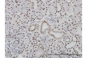 Image no. 1 for anti-Pre-B-Cell Leukemia Homeobox Protein 1 (PBX1) (AA 213-321) antibody (ABIN562114)