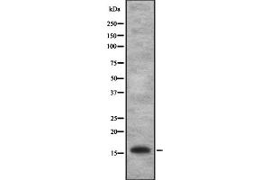 Image no. 1 for anti-Interleukin 1 Family, Member 10 (Theta) (IL1F10) (Internal Region) antibody (ABIN6257233)