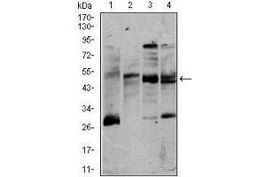 Image no. 3 for anti-CD5 (CD5) (AA 27-233) antibody (ABIN1098109)