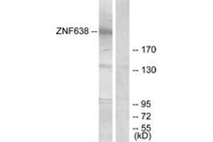 Image no. 1 for anti-Zinc Finger Protein 638 (ZNF638) (AA 1271-1320) antibody (ABIN1533895)