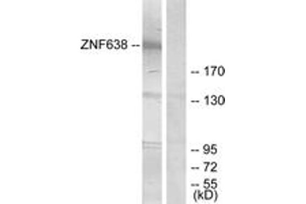 ZNF638 抗体  (AA 1271-1320)
