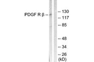 Western blot analysis of extracts from LOVO cells, treated with H2O2 100uM 30', using PDGFR beta (Ab-1021) Antibody.