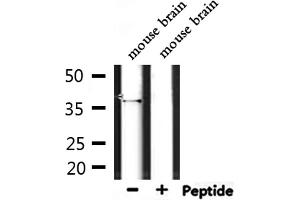 Image no. 2 for anti-Olfactory Receptor, Family 4, Subfamily D, Member 5 (OR4D5) antibody (ABIN6263864)