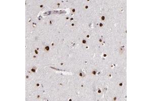 Image no. 1 for anti-Nucleoporin 62kDa C-terminal Like (NUP62CL) antibody (ABIN5584860)