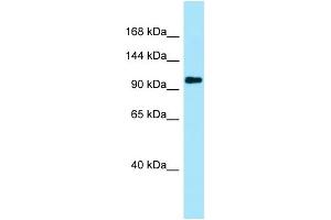 Image no. 1 for anti-Plakophilin 4 (PKP4) (N-Term) antibody (ABIN2789970)